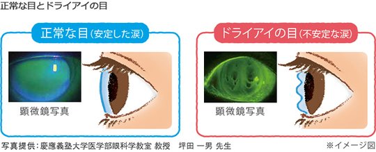 最新 ドライアイと涙道疾患ナビゲートー「涙」の問題はこの1冊